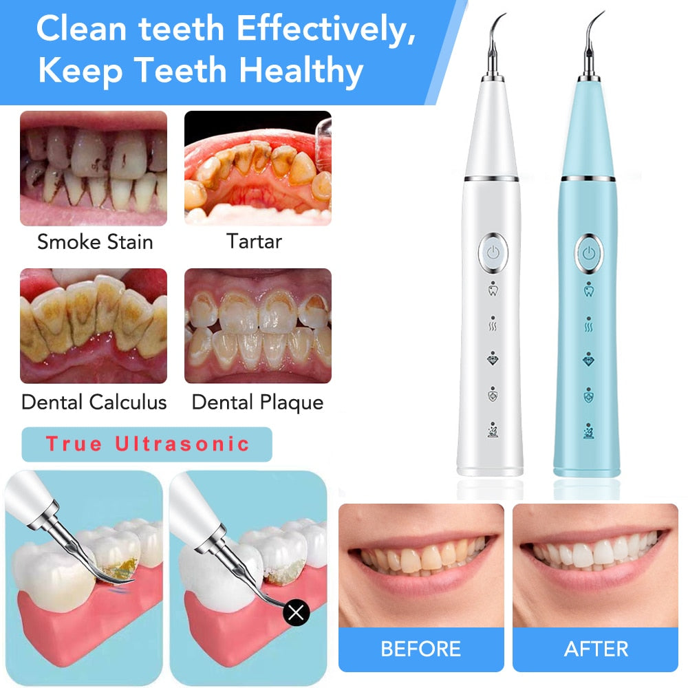 Plaque Remover for Teeth, - Bettylis