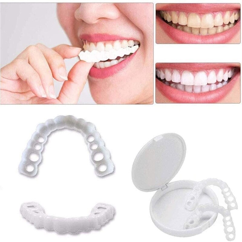 👨‍⚕Perfect Smile Brace Snap On😁