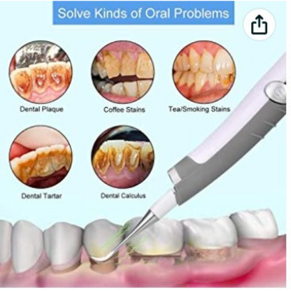 Sonic Tooth Stain Eraser And Plaque Remover